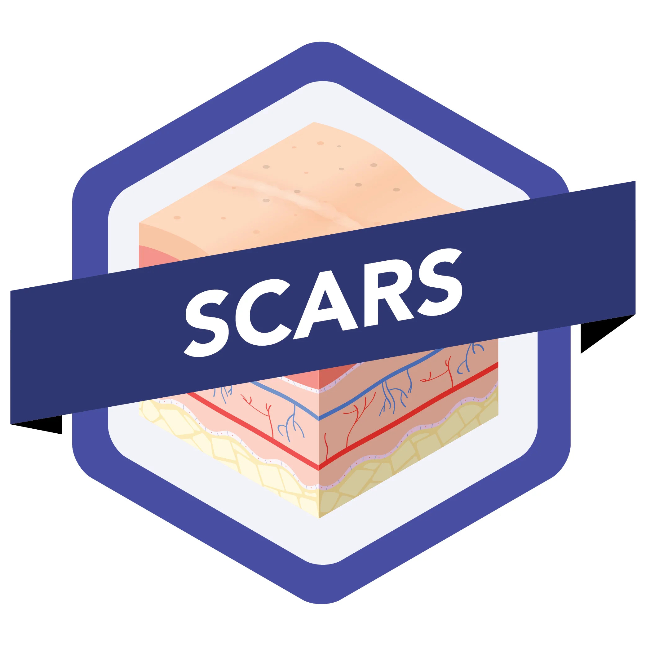 Wound_Guide_Images_Scars.jpg